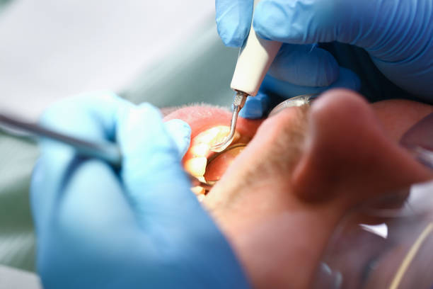 Best Emergency Broken Tooth Repair in Shortsville, NY